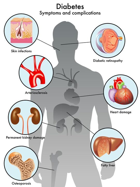 Insunol protegge gli organi bersaglio dalle complicanze